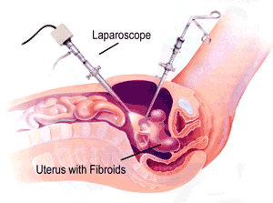 oid Treatment India