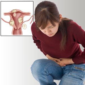 Fibroid Treatment in India